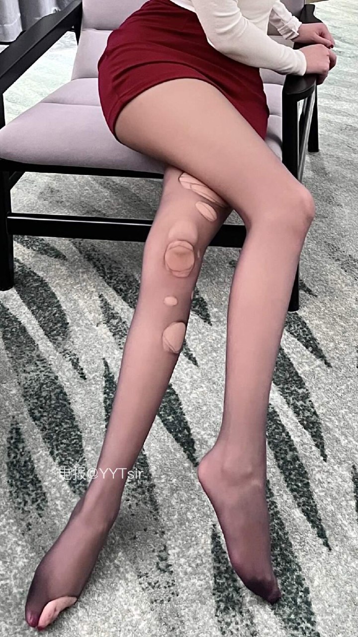 杨晨晨 2025-07-25 21:11:00 腿就好了吧？ 看看腿就好了吧？ 第9张