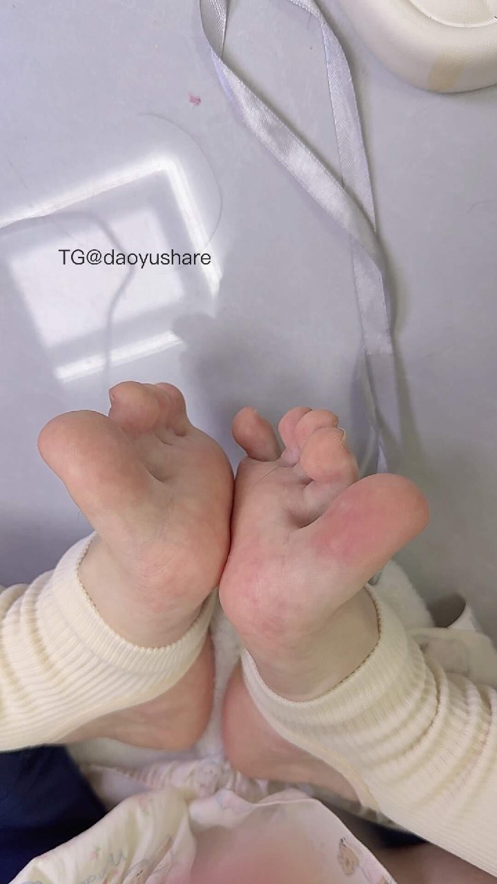 萌子哭哭 2025-08-01 16:26:26 红润小脚🫣🫣 第1张