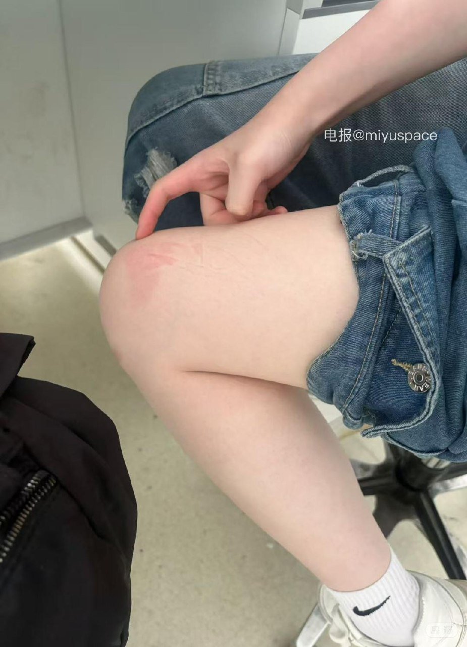 rice粥 2026-04-16 08:11:29 紧张