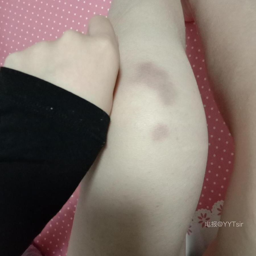 狼狼