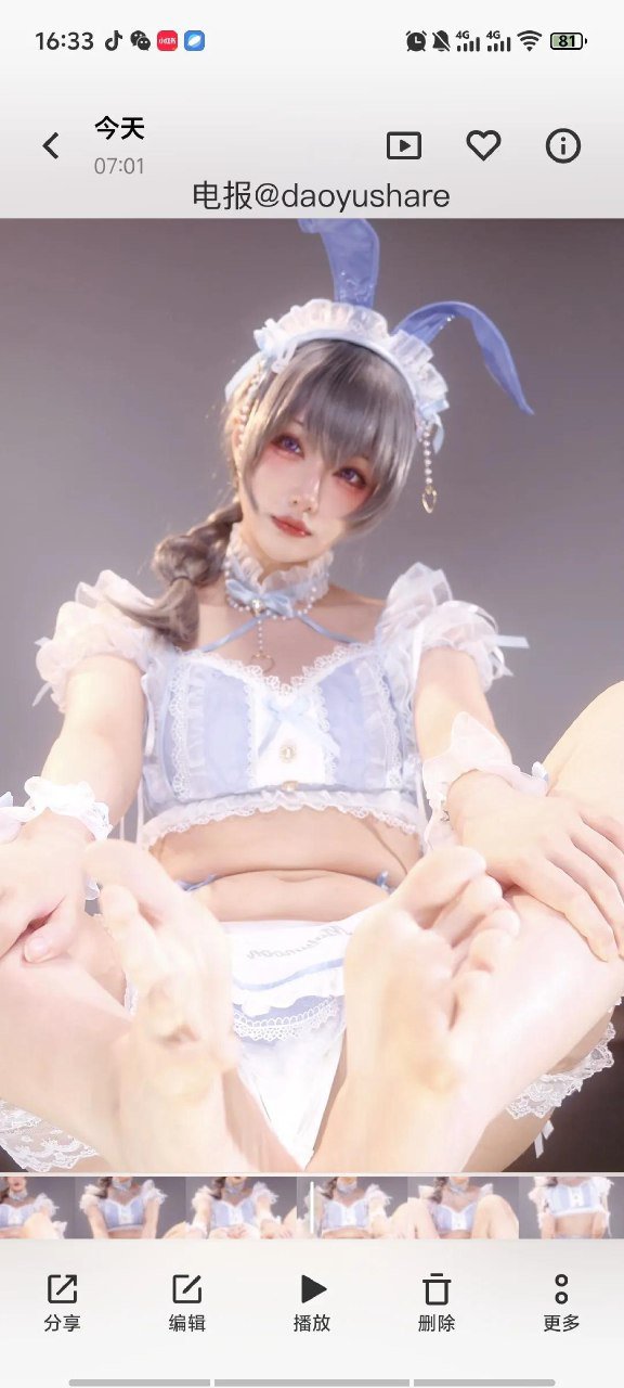 你被竺拱了 2026-04-25 17:38:15 梅里医疗兔私设cos